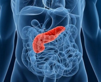Pancreatite Aguda